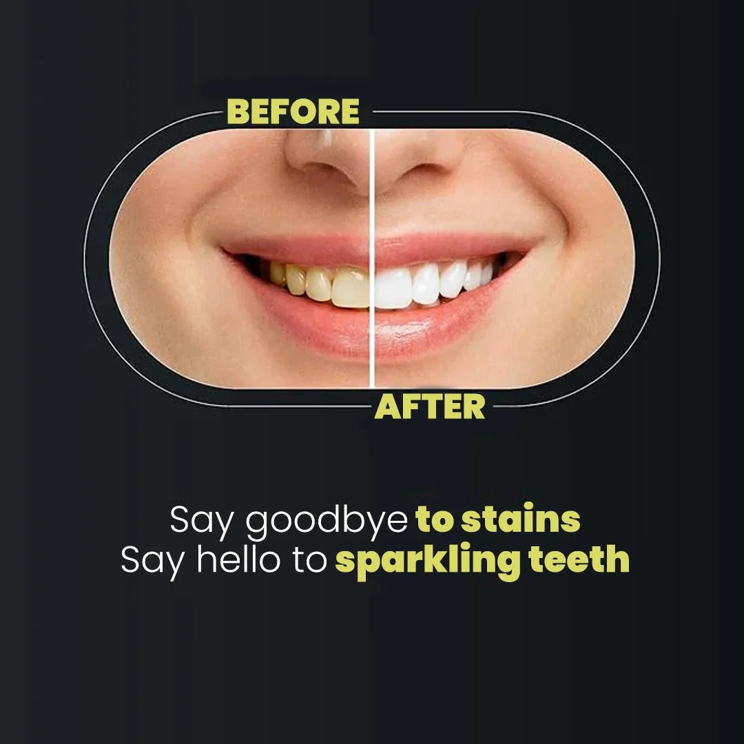 9D Teeth Whitening Strips – Professional Whitening Kit | Mint Flavor | 7 Pairs